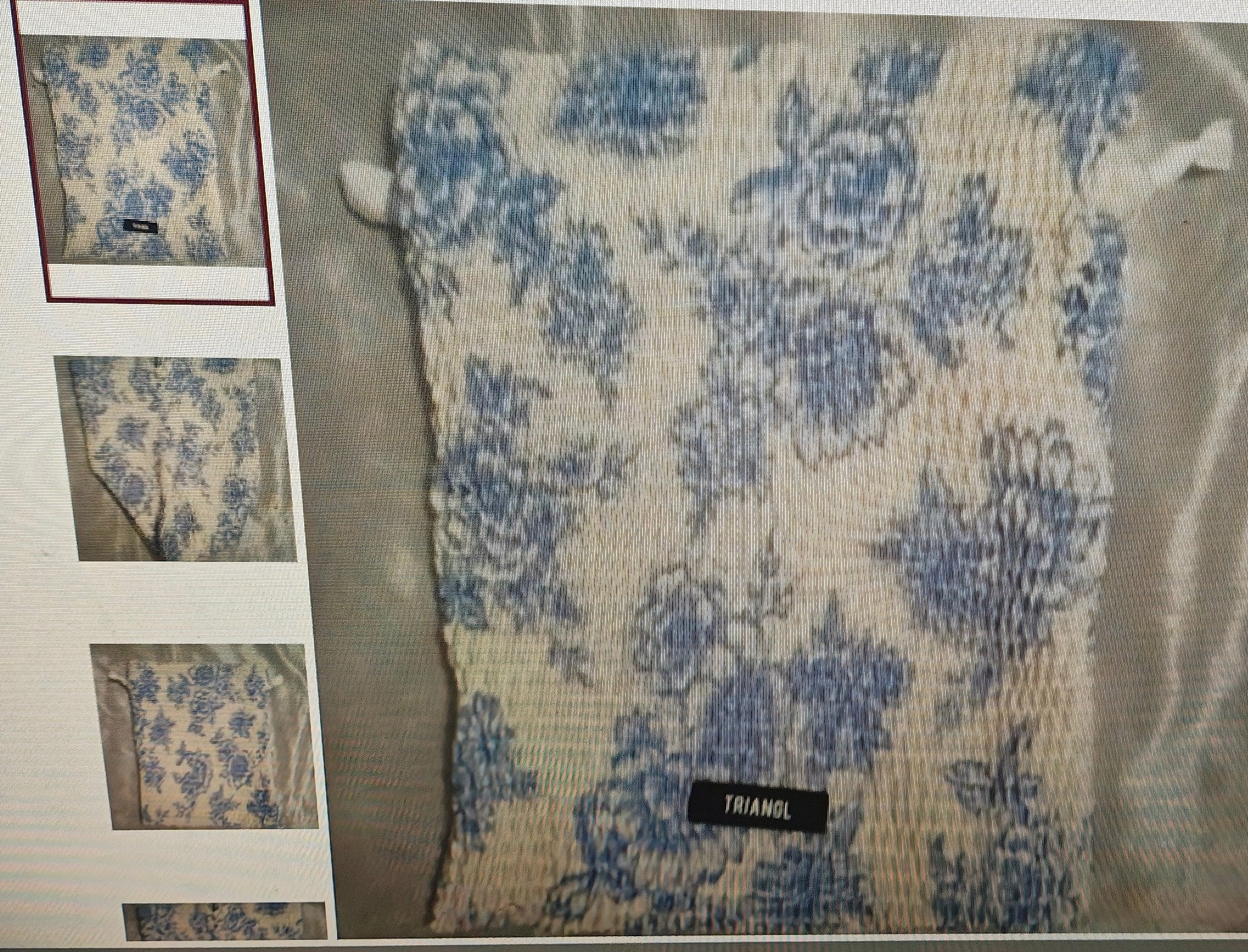 Fabric swatch with blue floral pattern on a beige background, surrounded by smaller fabric samples and a Triangl label.